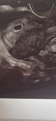 Clear blue says 2-3 weeks but I’m 6 weeks pregnant
