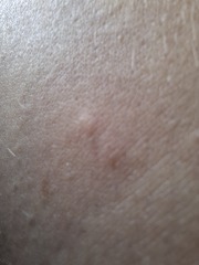 To burn the villa down