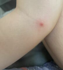 What are these spots on my DD?