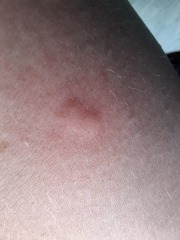 To burn the villa down