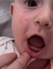 Will his teeth come through anytime soon?