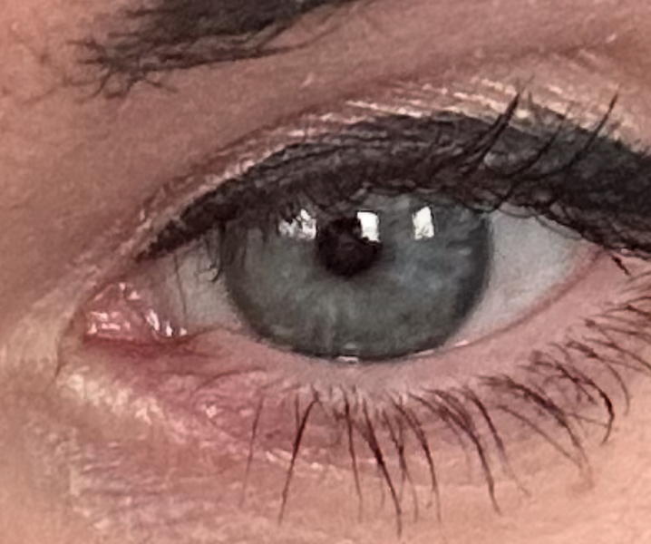 Eye colour