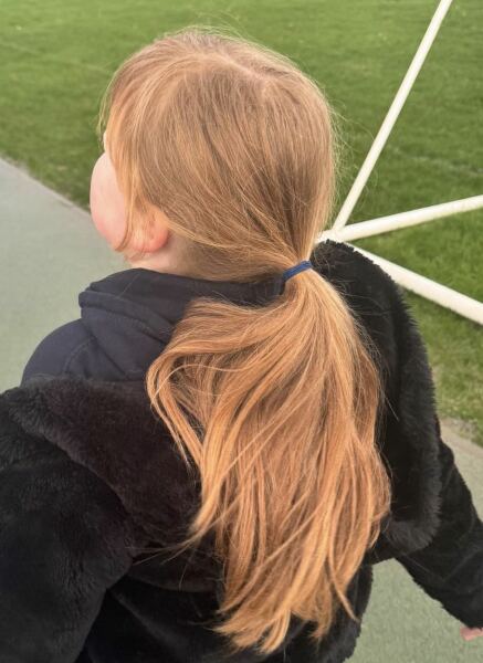 Worried about Dd being ginger in the uk