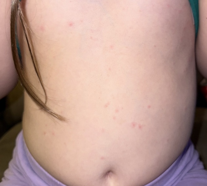 What could these spots/rash be?