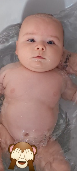 Baby breathing, subcostal retractions :(