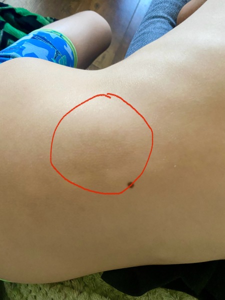 Birth mark? Skin damage? Uneven tan?