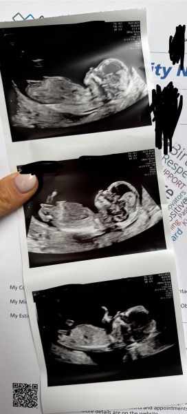 Bit of fun for curious boy mum expecting 3rd - hit me with gender theories please!