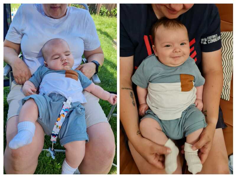 Did you keep baby clothes for future DC’s?