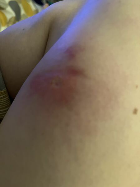 Is this infected?