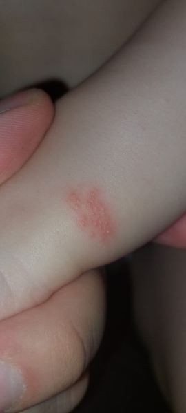 What is on my daughters wrist?