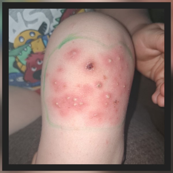 Is this a tonight emergency or can it wait to tomorrow?