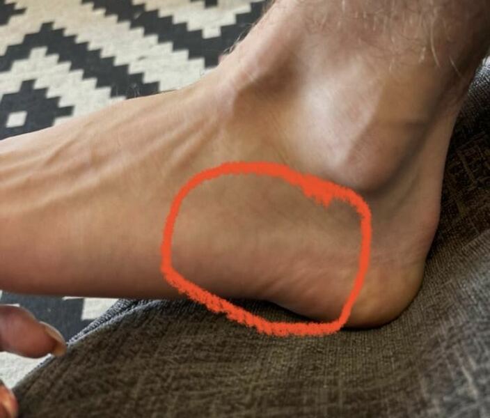 Injured foot…