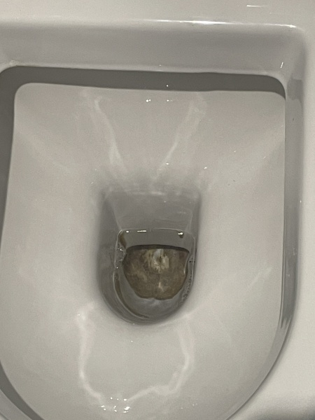 What are these stains and how do I get rid of them?