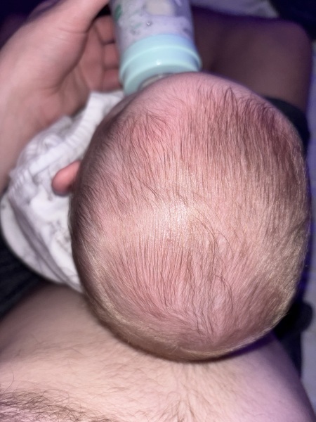 Is this plageocephaly?