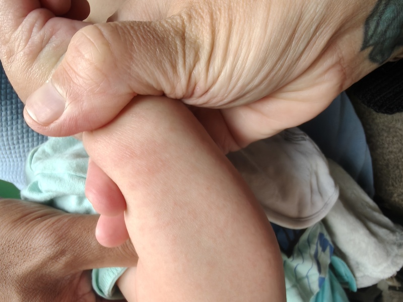 What is this rash please?