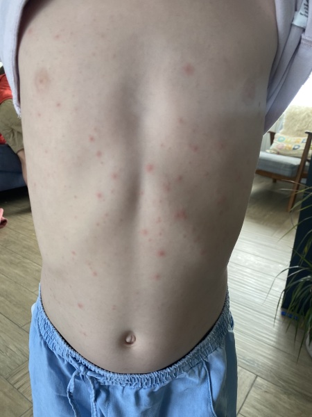 The Great Recovery part 4