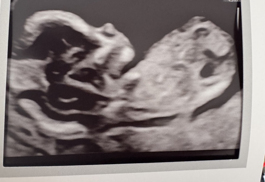 Girl or Boy?