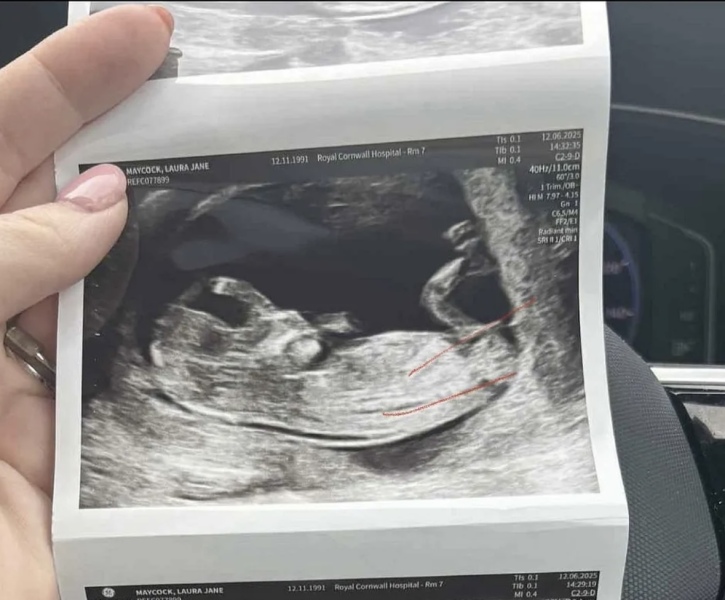 Boy or girl