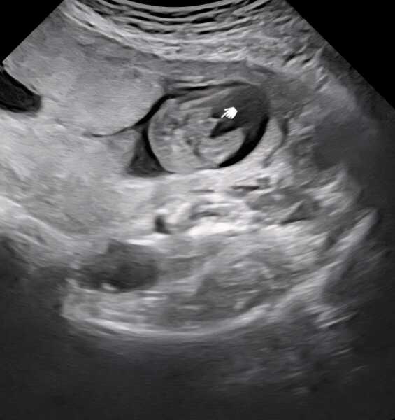 boy or girl? 16 weeks x