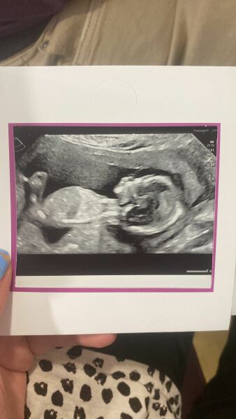 14+2 weeks girl or boy?