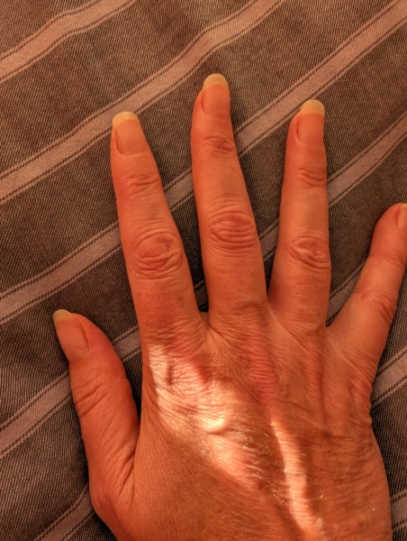 After biting my nails for 50 years…