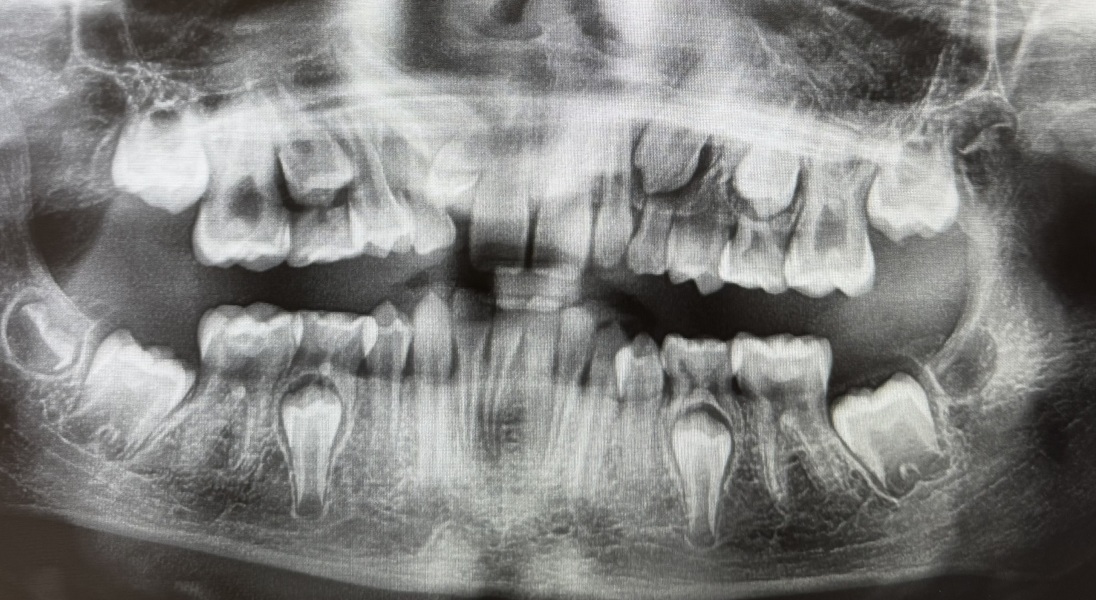 To sue the orthodontist?