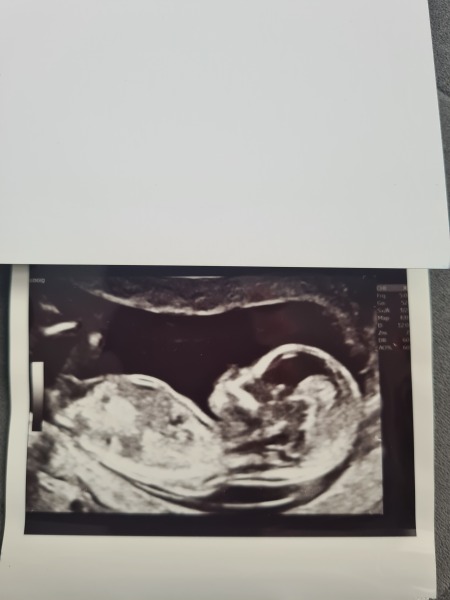 NUB theory, what are your thoughts on my scan?