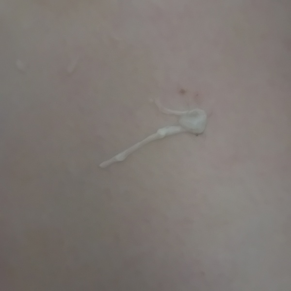 Stringy discharge- 27 weeks pregnant