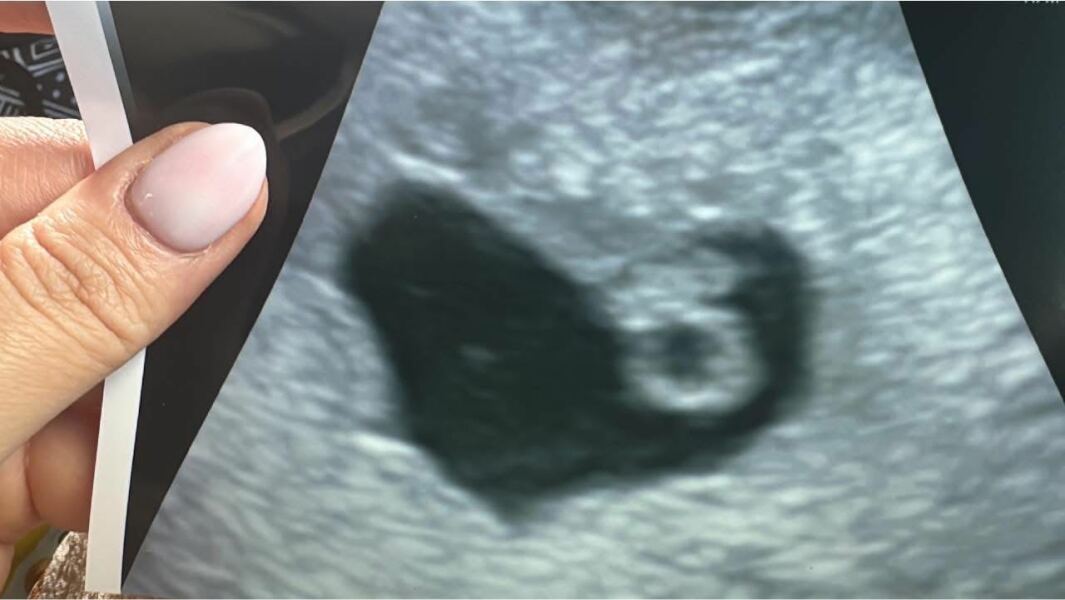 Due March 2026