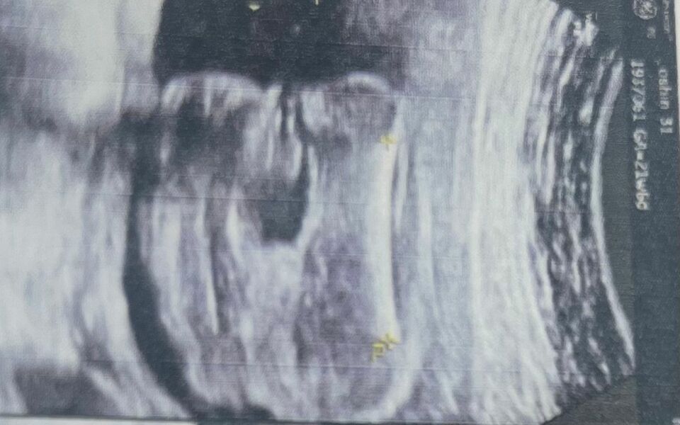 Potty Shot - Guess the Gender ( TRICKY )