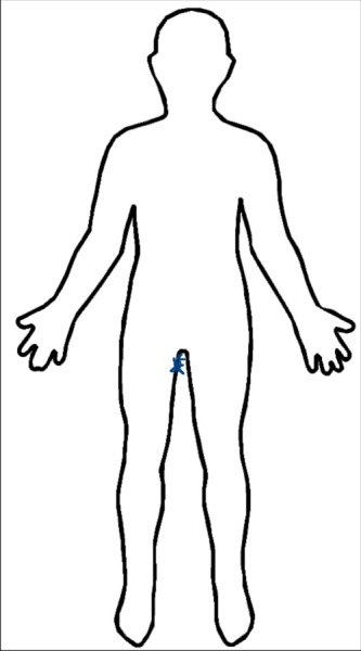 Terrible pain - possible hernia?