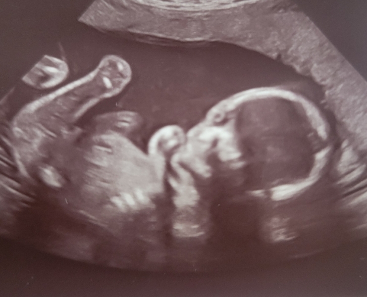 Sex of Baby, is it a boy??
