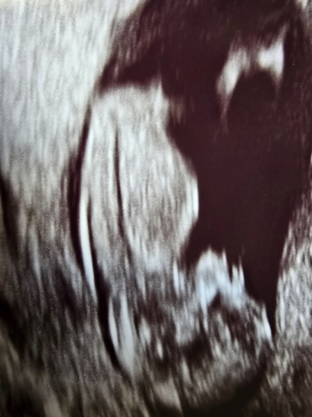 Gender of baby