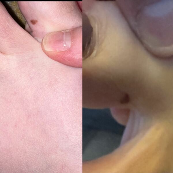 Mole