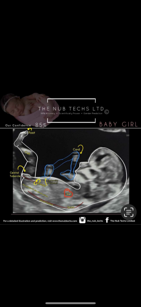 Gender experts vs nub techs vs nubologists