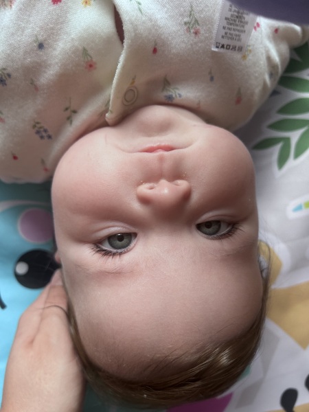 Are my child’s eyes ok?