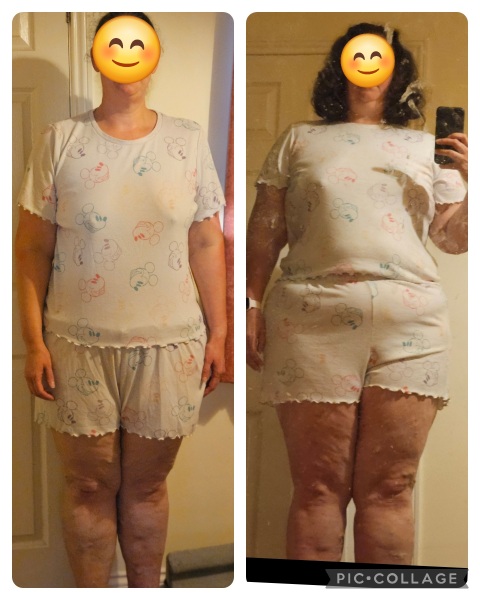 Mounjaro 10st or more to lose - Thread 5