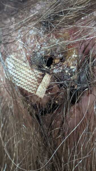 Do I Need To Go Back