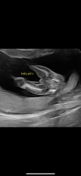 Is baby gender wrong ??!