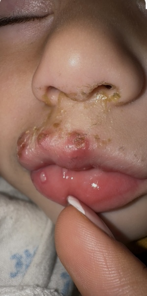 Dr not sure what this is, anyone’s LO had similar?