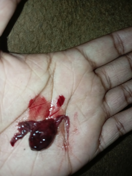Is this my baby? *Warning graphic pic! *