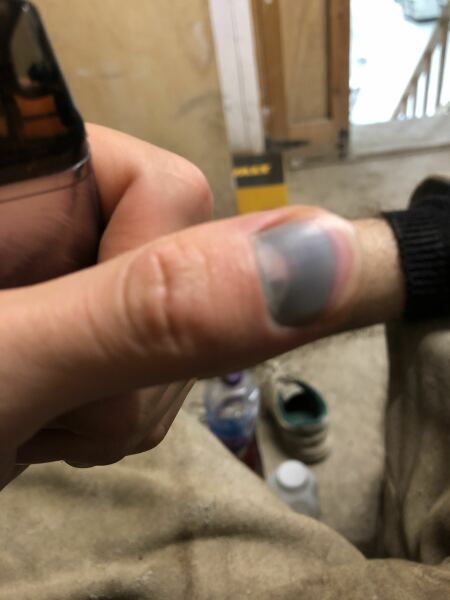 AIBU - to ask if my son should go to minor injuries?