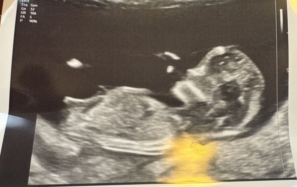 Due February 2026 - thread 2