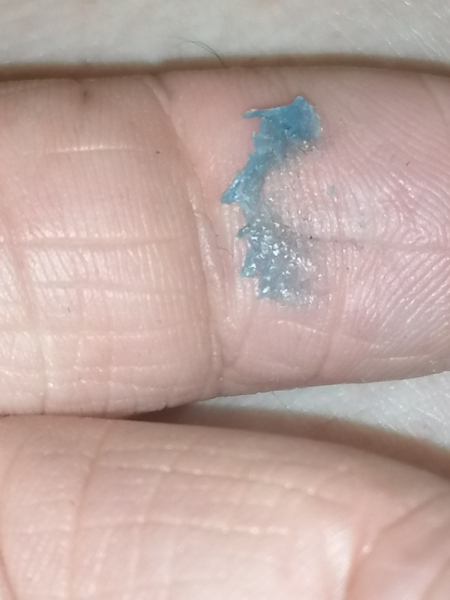 2 year old daughter swallowed a 50p coin !!!