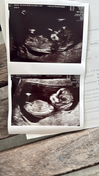 Boy or girl?