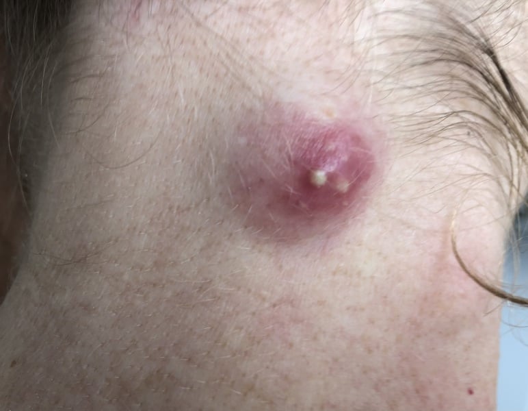 Help, pls - infected thing!