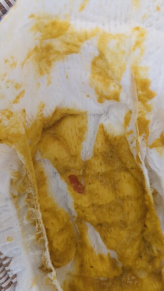 Persistent mucus in breastfed baby stool *photos*