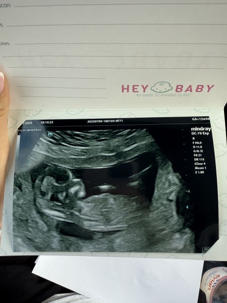 Boy or girl?
