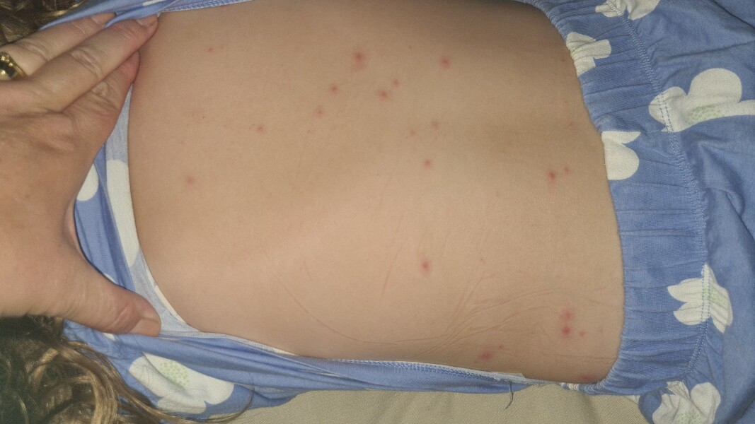What's biting my daughter