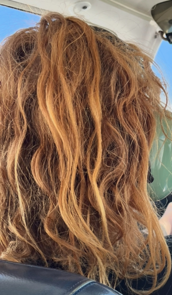 Worried about Dd being ginger in the uk
